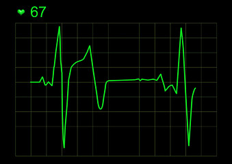 Image showing  ECG graph