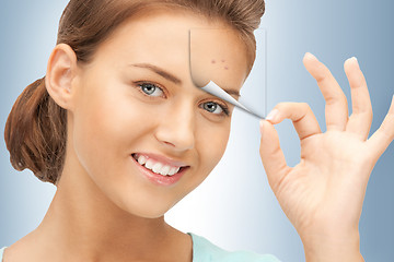 Image showing no more acne