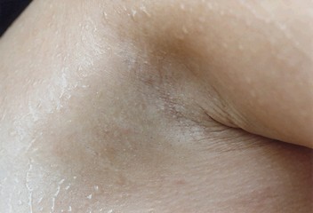 Image showing armpit