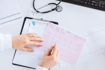 Image showing male doctor hands with cardiogram