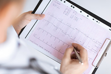 Image showing male doctor hands with cardiogram