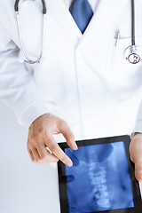 Image showing male doctor holding tablet pc with x-ray