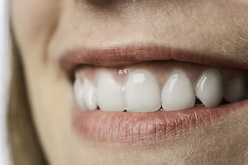 Image showing Closeup white teeth of young woman