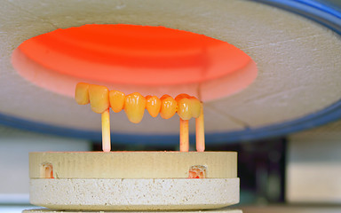 Image showing dental crowns, ceramics, furnace