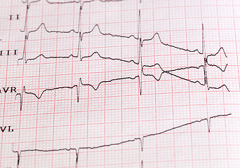 Image showing  cardiogram