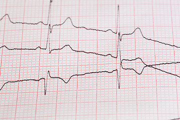 Image showing cardiogram