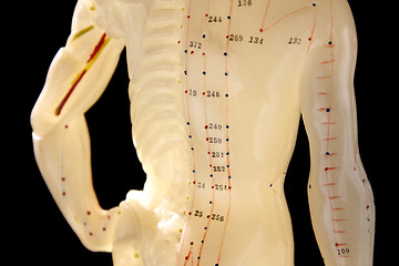 Image showing acupuncture figure 2