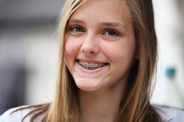 Image showing Young teenage girl with orthodontic braces