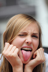 Image showing Yong girl with braces sticking out her tongue