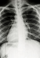 Image showing Chest xray scan