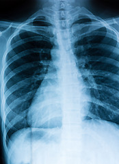 Image showing Chest xray scan