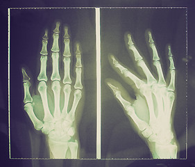 Image showing Retro look Xray