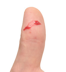 Image showing finger with blood