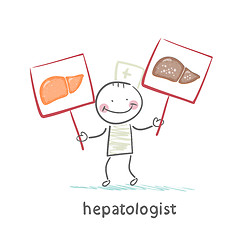 Image showing hepatologist holding signs with healthy and diseased liver