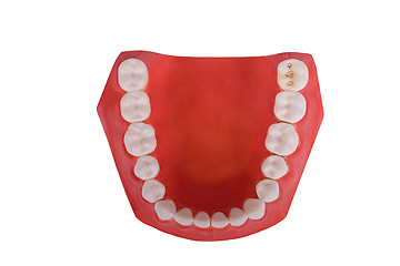 Image showing dentures, dental prosthesis