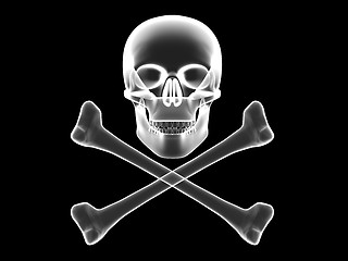 Image showing Skull and crossbones x-ray silhouette