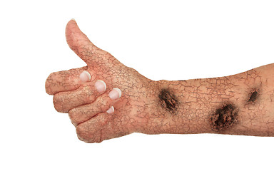 Image showing Old arm with cracks and rust, concept of getting old, giving the