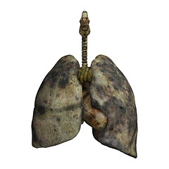 Image showing Lungs of Smokers