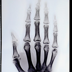 Image showing Xray