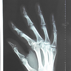 Image showing Xray