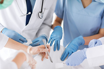 Image showing young group of doctors doing operation