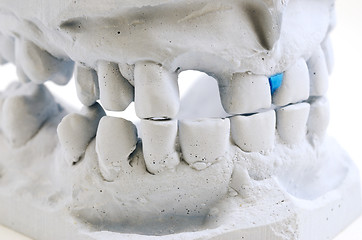 Image showing detailed macro of teeth molding 