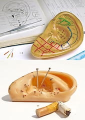 Image showing Acupuncture to stop smoking