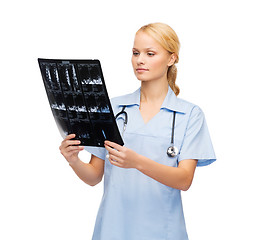 Image showing serious doctor or nurse looking at x-ray
