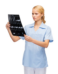 Image showing serious doctor or nurse looking at x-ray