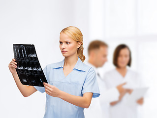 Image showing serious doctor or nurse looking at x-ray