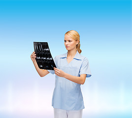 Image showing serious doctor or nurse looking at x-ray