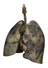 Image showing Lungs of Female Smokers