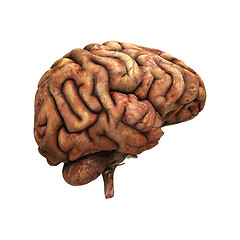 Image showing Sick Human Brain