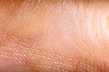 Image showing Close up human skin. Macro epidermis 