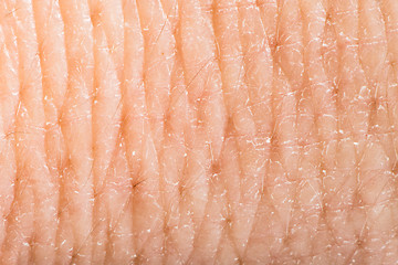 Image showing Close up human skin. Macro epidermis 