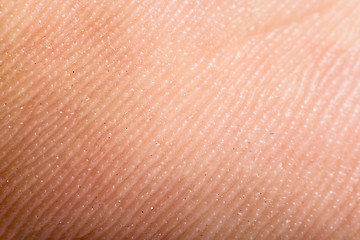 Image showing Close up human skin. Macro epidermis 