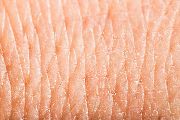 Image showing Close up human skin. Macro epidermis 