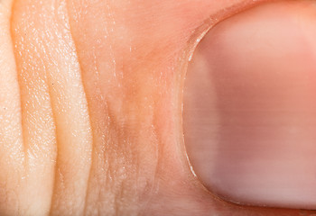 Image showing Close up human skin and claw. Macro epidermis 