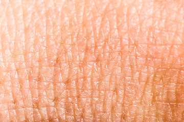 Image showing Close up human skin. Macro epidermis 