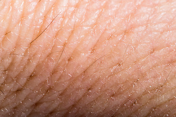 Image showing Close up human skin. Macro epidermis 