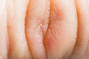 Image showing Close up human skin. Macro epidermis 