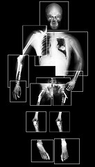 Image showing X-ray of lungs