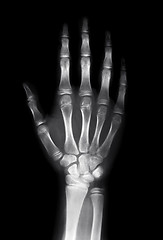 Image showing Human hand