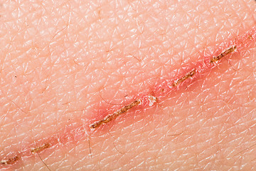 Image showing Texture of human skin and scratch