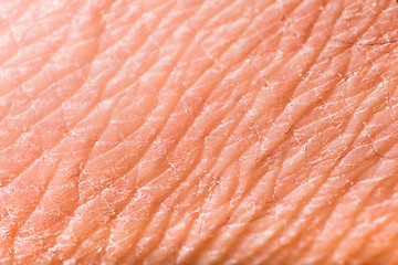 Image showing Texture of human skin