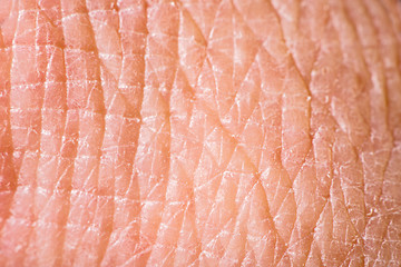 Image showing Texture of human skin