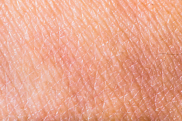 Image showing Texture of human skin