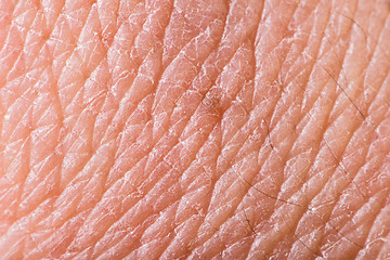 Image showing Texture of human skin