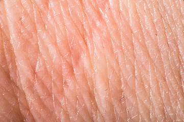 Image showing Texture of human skin