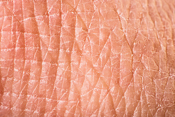 Image showing Texture of human skin